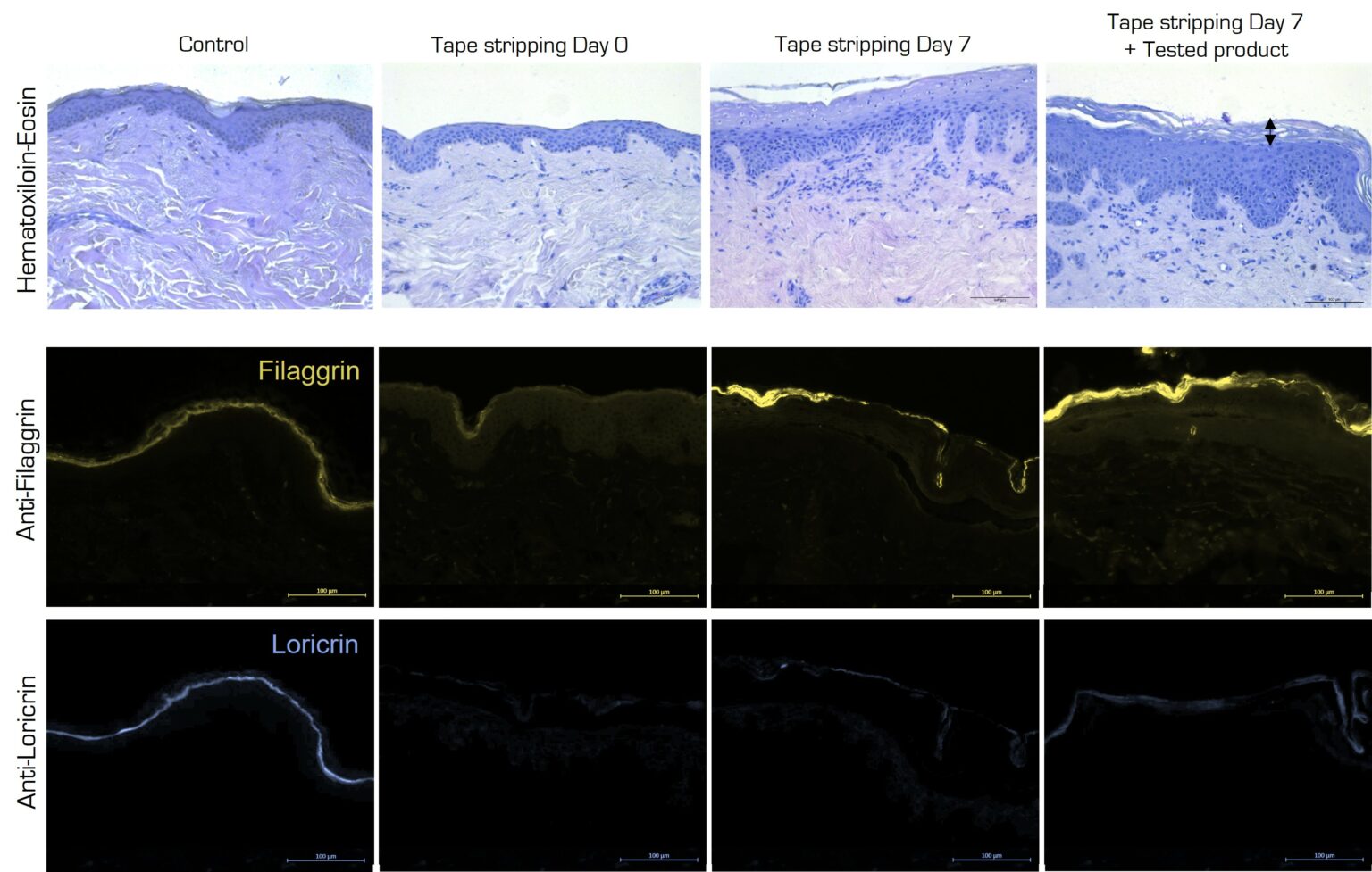 Tissue regeneration on ex vivo human skin model - Syntivia